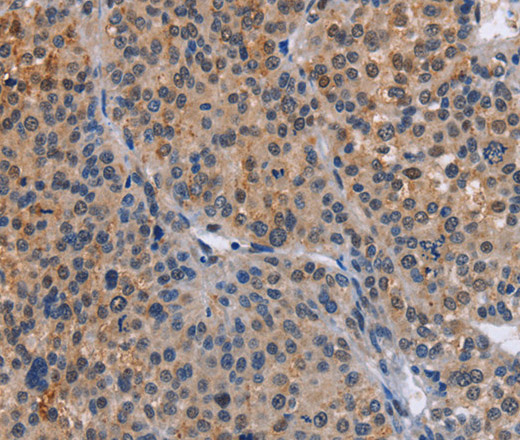 MAP3K13 Polyclonal Antibody (E-AB-14698)