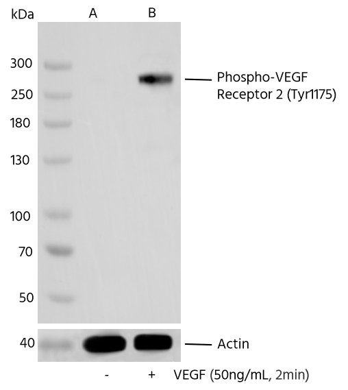 Recombinant Phospho-VEGF Receptor 2 (Tyr1175) Monoclonal Antibody (AN300385L)