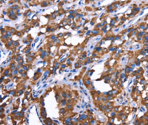 GREB1 Polyclonal Antibody (E-AB-16472)