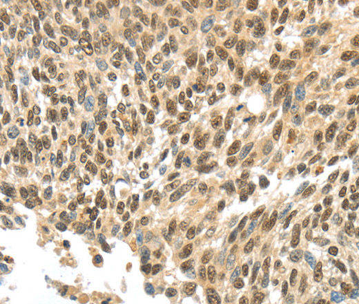 APOL6 Polyclonal Antibody (E-AB-16261)