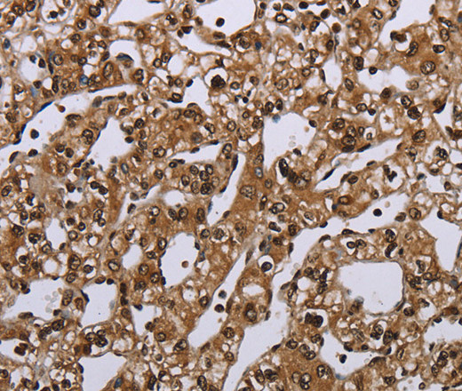 MEIS1 Polyclonal Antibody (E-AB-16601)