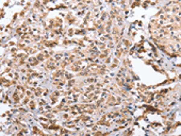 ZFYVE16 Polyclonal Antibody (E-AB-53234)