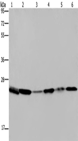 ARHGDIA Polyclonal Antibody (E-AB-15064)