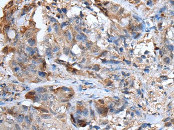 CXCL5 Polyclonal Antibody (E-AB-53484)
