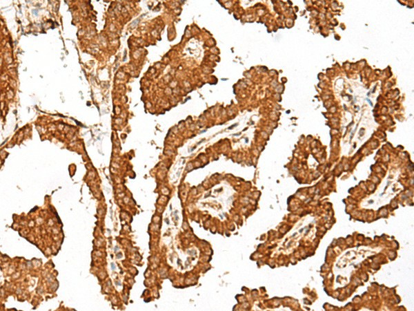 GBP4 Polyclonal Antibody (E-AB-19901)