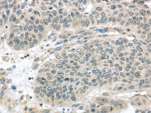THAP4 Polyclonal Antibody (E-AB-17066)