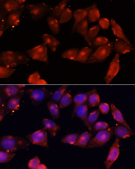 ACVR2B Polyclonal Antibody (E-AB-65562)