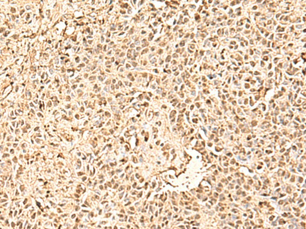 SMNDC1 Polyclonal Antibody (E-AB-52865)