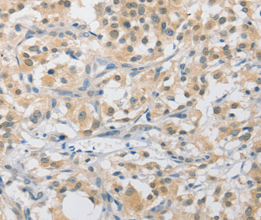 APLF Polyclonal Antibody (E-AB-10816)