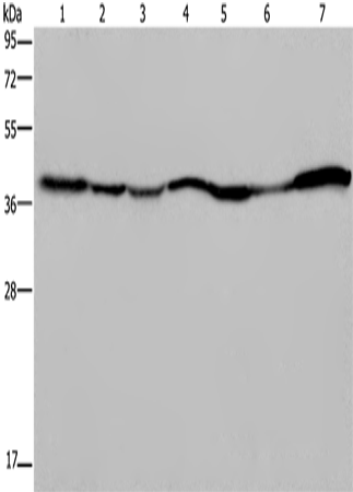 GOT2 Polyclonal Antibody (E-AB-11280)