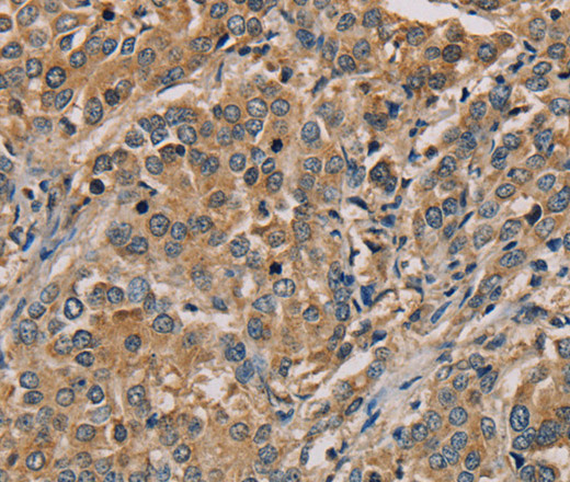 NANOS2 Polyclonal Antibody (E-AB-11419)