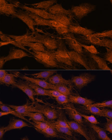 COMMD5 Polyclonal Antibody (E-AB-66839)