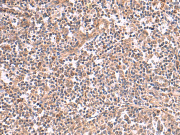 SLC12A7 Polyclonal Antibody (E-AB-18163)