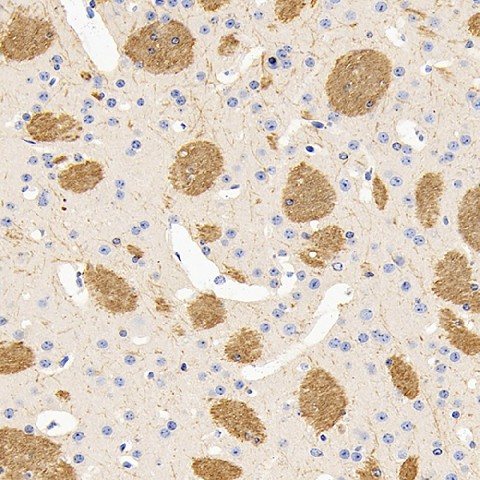 MBP Polyclonal Antibody (E-AB-70266)
