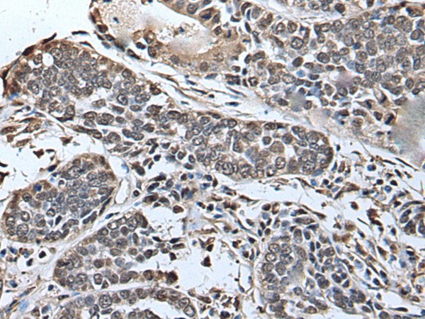 SLITRK5 Polyclonal Antibody (E-AB-18289)