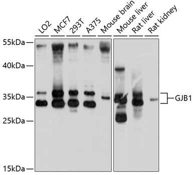 GJB1 Polyclonal Antibody (E-AB-90074)