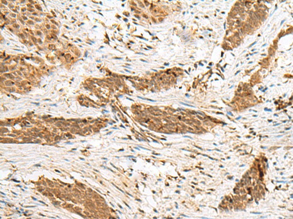 NUP58 Polyclonal Antibody (E-AB-18851)