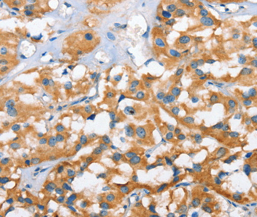 CXCL14 Polyclonal Antibody (E-AB-10342)