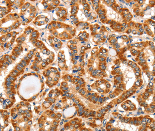 AIM2 Polyclonal Antibody (E-AB-10974)