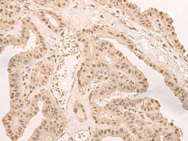 CNOT10 Polyclonal Antibody (E-AB-18752)