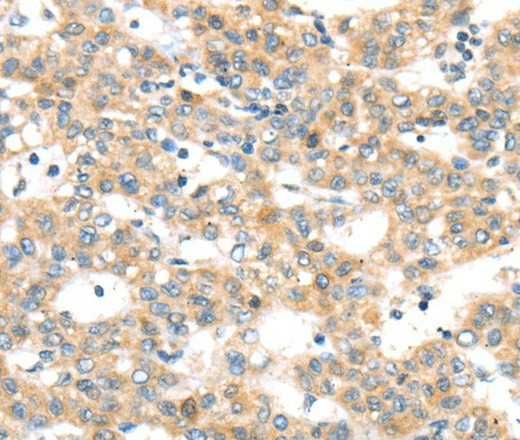 RAB24 Polyclonal Antibody (E-AB-16749)