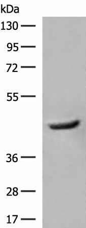 GCAT Polyclonal Antibody (E-AB-18831)