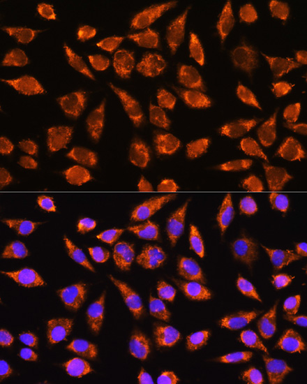 MARK2 Polyclonal Antibody (E-AB-66909)