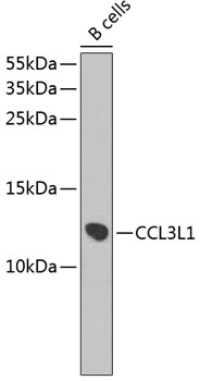 CCL3L1 Polyclonal Antibody (E-AB-62907)