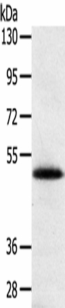 SMOC2 Polyclonal Antibody (E-AB-16862)