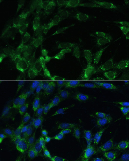 BCAT2 Polyclonal Antibody (E-AB-61694)