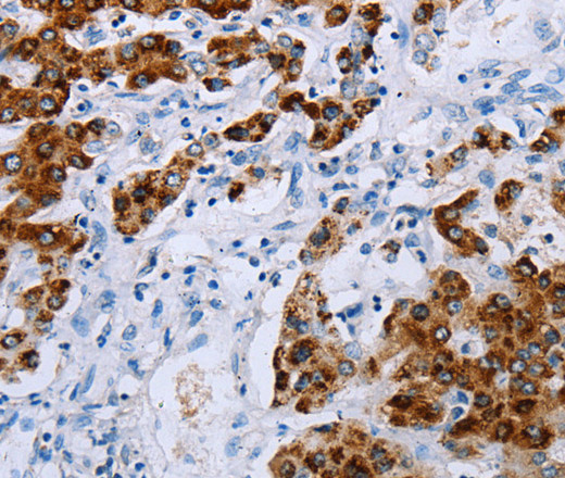 NDUFA12 Polyclonal Antibody (E-AB-12368)
