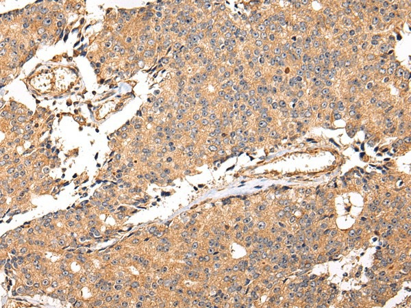 ALDH3A2 Polyclonal Antibody (E-AB-17211)