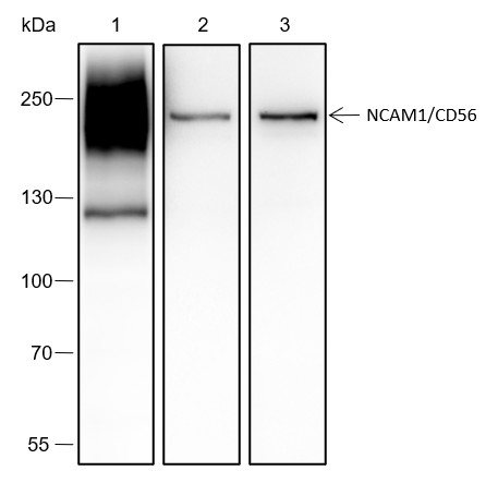 Recombinant NCAM1/CD56 Monoclonal Antibody (AN301702L)