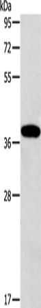 ALDOB Polyclonal Antibody (E-AB-16149)