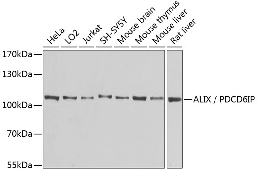 ALIX / PDCD6IP Polyclonal Antibody (E-AB-68349)