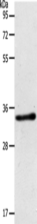 ACY3 Polyclonal Antibody (E-AB-10726)