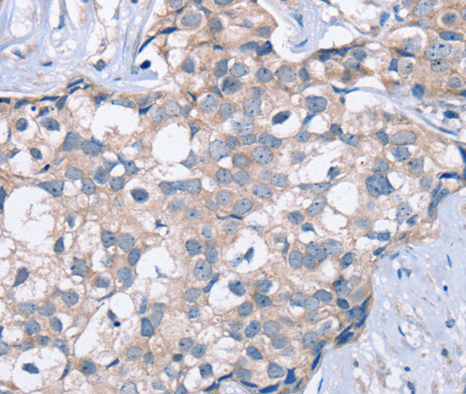 KCNQ5 Polyclonal Antibody (E-AB-11349)