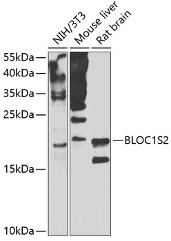 BLOC1S2 Polyclonal Antibody (E-AB-67938)