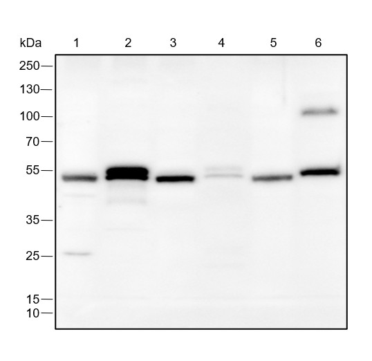 Recombinant FLI1 Monoclonal Antibody (AN301523L)