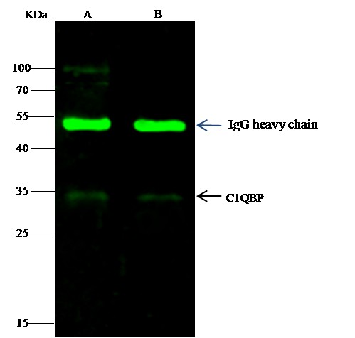 Recombinant C1QBP/HABP1 Monoclonal Antibody (AN300492P)