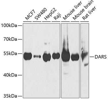 DARS Polyclonal Antibody (E-AB-61223)