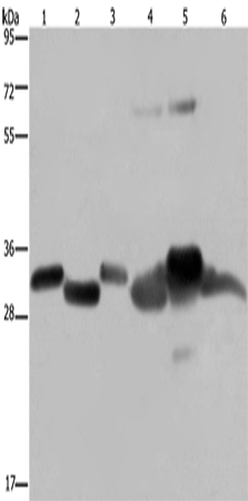 HMGCL Polyclonal Antibody (E-AB-15095)