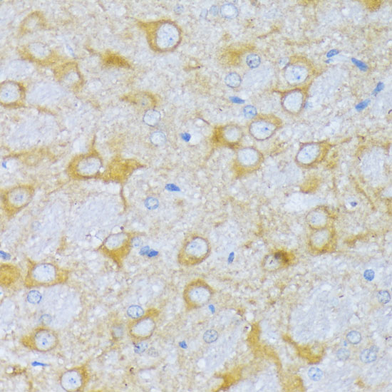 ACADSB Polyclonal Antibody (E-AB-66388)