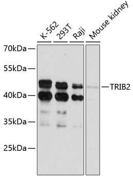TRIB2 Polyclonal Antibody (E-AB-90286)