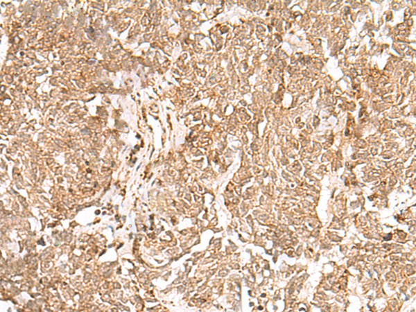 GMPPB Polyclonal Antibody (E-AB-52910)