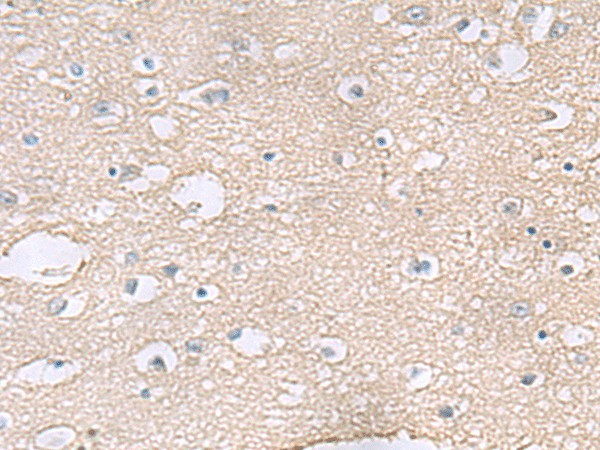TAGLN3 Polyclonal Antibody (E-AB-53076)