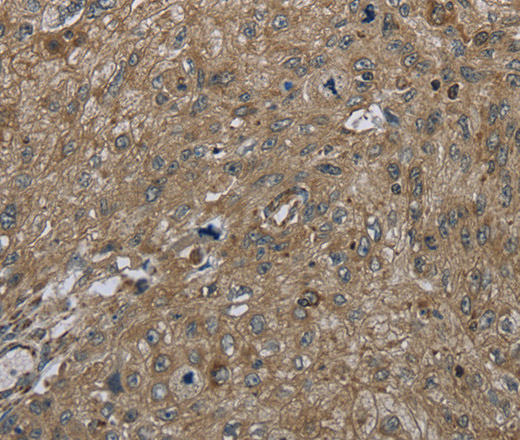 CLPS Polyclonal Antibody (E-AB-11089)