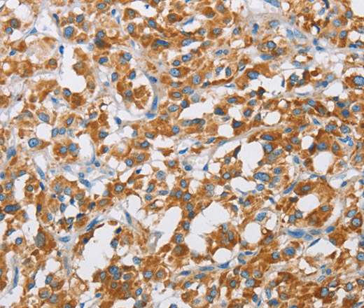 BDH1 Polyclonal Antibody (E-AB-14789)