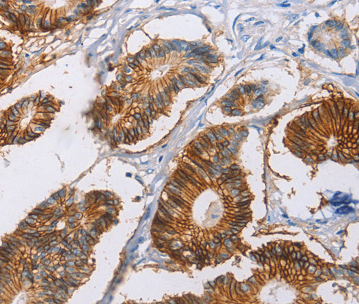 CA9 Polyclonal Antibody (E-AB-13968)
