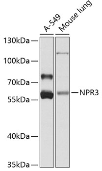 NPR3 Polyclonal Antibody (E-AB-62846)